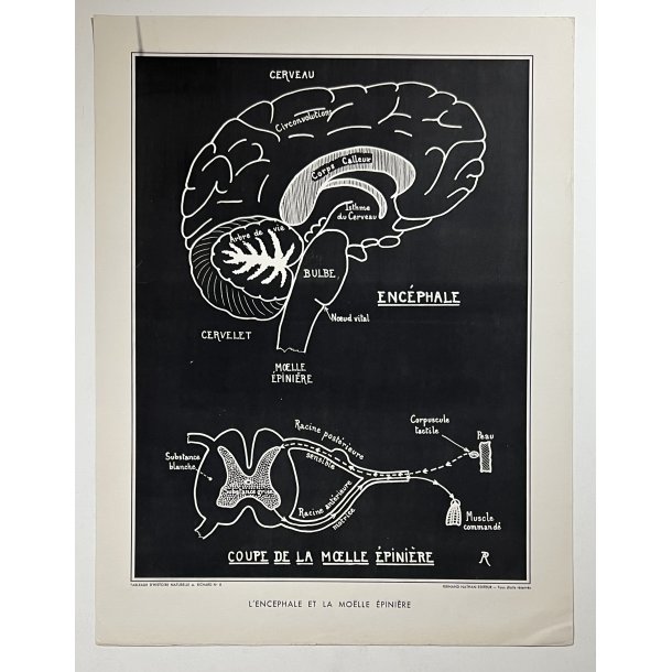 Anatomi Plakat - Hjerne &amp; Rygmarv